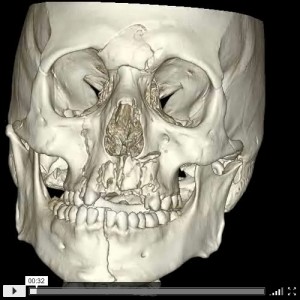 motorcycle_no_helmet_1-300x300